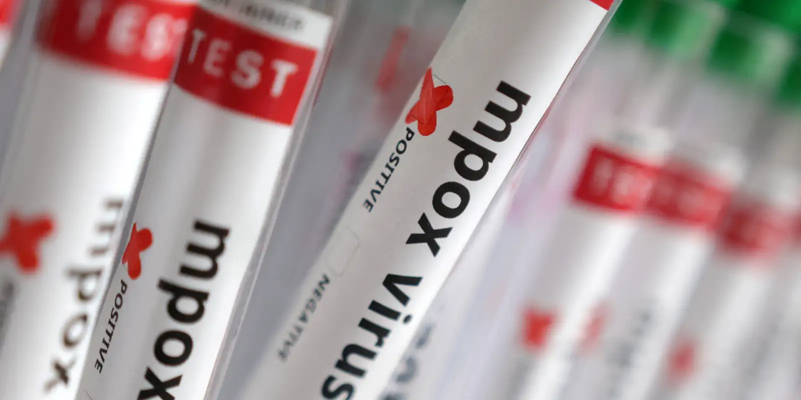 sobe-para-140-numero-de-casos-confirmados-de-mpox-no-pais,-em-2026