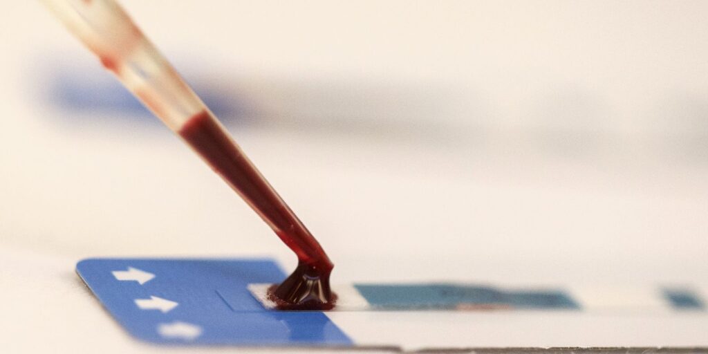 estudo-inedito-da-fiocruz-pode-ampliar-prevencao-de-hiv-entre-jovens