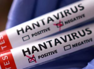 1200-675-26650794-thumbnail-16x9-hantavirus-1-aspera