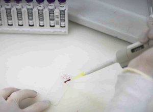 paciente-em-sp-com-suspeita-de-ebola-testa-positivo-para-meningite